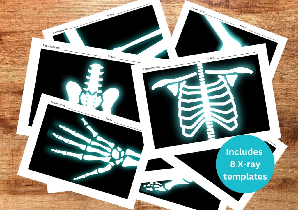 Printable X rays For Kids Pretend Play Kids X ray Activity Etsy